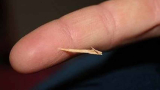 Splinter Removal Hack